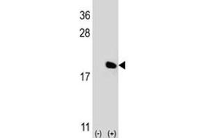 Western blot analysis of IL-17 antibody and 293 cell lysate (2 ug/lane) either nontransfected (Lane 1) or transiently transfected (2) with the IL17A gene. (Interleukin 17a anticorps  (AA 61-87))