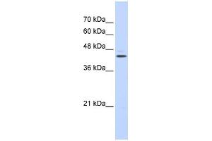 WB Suggested Anti-GABPB2 Antibody Titration: 0. (GABPB2 anticorps  (N-Term))