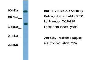 WB Suggested Anti-MED25  Antibody Titration: 0. (MED25 anticorps  (N-Term))
