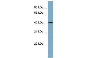 WB Suggested Anti-TSSK2 Antibody Titration: 0. (TSSK2 anticorps  (Middle Region))