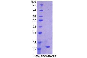 SDS-PAGE (SDS) image for Indoleamine 2,3-Dioxygenase (IDO) (AA 106-190) protein (His tag) (ABIN1980962)