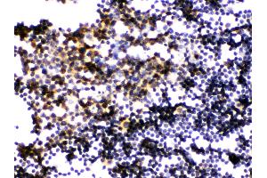 Anti- PLK1 Picoband antibody,IHC(P) IHC(P): Mouse Lymphaden Tissue (PLK1 anticorps  (AA 86-430))