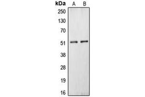 Western blot analysis of Carboxypeptidase N 1 expression in HepG2 (A), HEK293T (B) whole cell lysates.