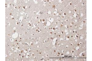 Immunoperoxidase of purified MaxPab antibody to ZNF483 on formalin-fixed paraffin-embedded human cerebral cortex.