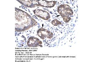 Human Stomach (MEOX1 anticorps  (N-Term))