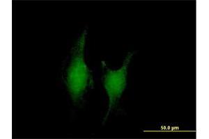 Immunofluorescence of purified MaxPab antibody to TRAF5 on HeLa cell. (TRAF5 anticorps  (AA 1-557))