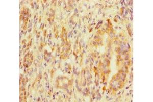 Immunohistochemistry of paraffin-embedded human pancreatic tissue using ABIN7159120 at dilution of 1:100 (MED29 anticorps  (AA 1-212))