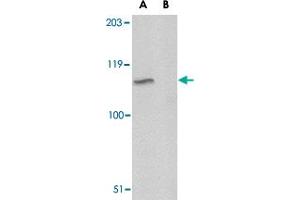 Western blot analysis of GP6 in A-20 lysate with GP6 polyclonal antibody  at 1 ug/m in either the absence or (B) the presence of blocking peptide. (GP6 anticorps  (C-Term))