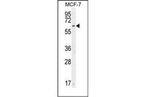 Western blot analysis of CTDSPL2 Antibody (N-term) in MCF-7 cell line lysates (35ug/lane).