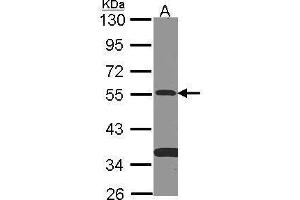 WB Image Sample (30 ug of whole cell lysate) A: NT2D1 10% SDS PAGE antibody diluted at 1:500 (SMAD9 anticorps)