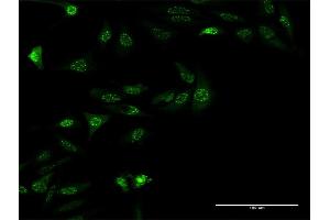 Immunofluorescence of monoclonal antibody to ZSCAN18 on HeLa cell. (ZSCAN18 anticorps  (AA 1-510))