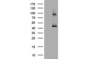 Image no. 1 for anti-Melanoma Antigen Family A, 3 (MAGEA3) antibody (ABIN1499258) (MAGEA3 anticorps)