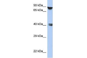 WB Suggested Anti-ZNF429 Antibody Titration:  0. (ZNF429 anticorps  (N-Term))