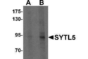 Western blot analysis of SYTL5 in Hela cell lysate with SYTL5 antibody at (A) 1 and (B) 2 µg/mL . (SYTL5 anticorps  (N-Term))