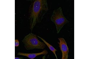 Immunofluorescence staining of methanol-fixed Hela cells using GAP43(Ab-41) Antibody. (GAP43 anticorps)