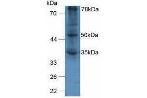 Detection of vWA2 in Human A375 Cells using Polyclonal Antibody to Von Willebrand Factor A Domain Containing Protein 2 (vWA2)