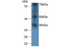 Detection of vWA2 in Human A375 Cells using Polyclonal Antibody to Von Willebrand Factor A Domain Containing Protein 2 (vWA2) (VWA2 anticorps  (AA 457-708))