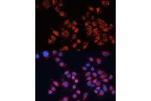 Immunofluorescence analysis of HeLa cells using Cation-independent M6PR (Cation-independent M6PR (IGF2R)) antibody (ABIN6130063, ABIN6142247, ABIN6142248 and ABIN6216853) at dilution of 1:100. (IGF2R anticorps  (AA 2327-2491))