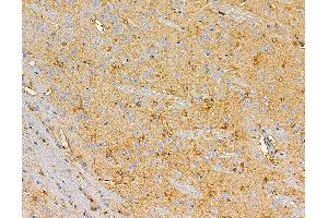 ABIN7095877 and ABIN7099939 at 1/100 staining rat brain tissue by IHC-P. (PLA2G12B anticorps)