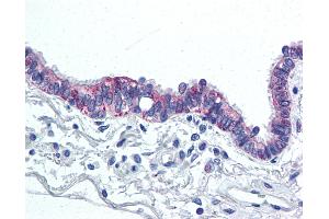 Anti-IL-6 antibody IHC of human lung, respiratory epithelium.