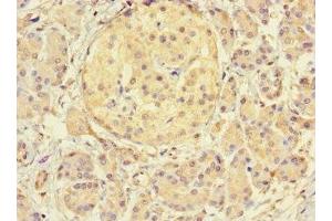 Immunohistochemistry of paraffin-embedded human pancreatic tissue using ABIN7172144 at dilution of 1:100 (THADA anticorps  (AA 432-651))