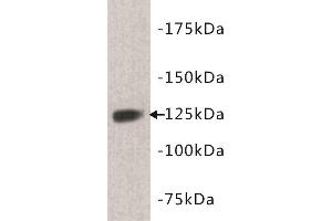 Western Blotting (WB) image for anti-tyrosine Kinase with Immunoglobulin-Like and EGF-Like Domains 1 (TIE1) (N-Term) antibody (ABIN1854998) (TIE1 anticorps  (N-Term))