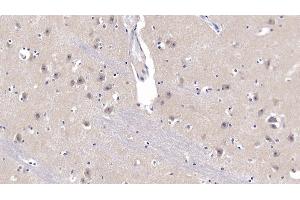 Detection of APP in Human Cerebrum Tissue using Polyclonal Antibody to Amyloid Precursor Protein (APP)