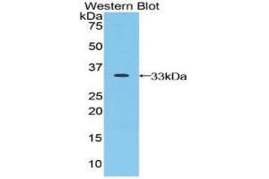Western Blotting (WB) image for anti-Jagged 2 (JAG2) (AA 714-981) antibody (ABIN3202318) (JAG2 anticorps  (AA 714-981))