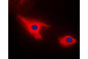 Immunofluorescent analysis of Septin 7 staining in HepG2 cells.