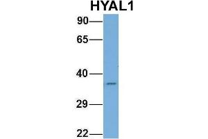 Host:  Rabbit  Target Name:  HYAL1  Sample Type:  Human Fetal Brain  Antibody Dilution:  1.