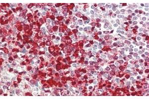 Detection of IL1RL1 in Human Spleen Tissue using Polyclonal Antibody to Interleukin 1 Receptor Like Protein 1 (IL1RL1) (IL1RL1 anticorps  (AA 162-349))