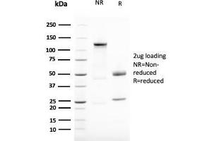 SDS-PAGE Analysis Purified Vimentin Mouse Monoclonal Antibody (VIM/1937R).