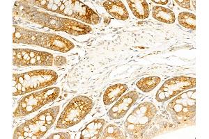 ABIN6257471 and ABIN6274750 at 1/100 staining Rat colorectal tissue by IHC-P. (RPS18 anticorps  (C-Term))