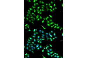 Immunofluorescence analysis of A549 cell using KIAA1456 antibody. (KIAA1456 anticorps)