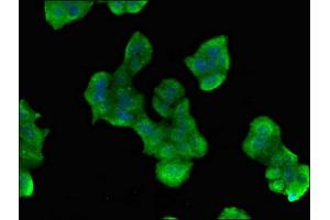 Immunofluorescent analysis of PC-3 cells using ABIN7163021 at dilution of 1:100 and Alexa Fluor 488-congugated AffiniPure Goat Anti-Rabbit IgG(H+L) (PES1 anticorps  (AA 378-588))