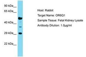 Image no. 1 for anti-Olfactory Receptor, Family 6, Subfamily Q, Member 1 (OR6Q1) (C-Term) antibody (ABIN6750774) (OR6Q1 anticorps  (C-Term))