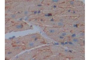 Detection of CD147 in Mouse Heart Tissue using Polyclonal Antibody to Cluster Of Differentiation 147 (CD147)