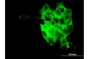 anti-Synaptotagmin IV (SYT4) (AA 1-99) antibody