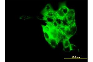 Immunofluorescence of monoclonal antibody to SYT4 on A-431 cell. (SYT4 anticorps  (AA 1-99))