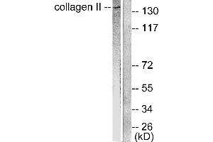 Western blot analysis of extracts from COLO205 cells, using Collagen II antibody (#C0155). (COL2 anticorps)