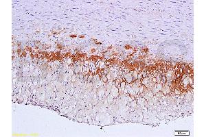 Formalin-fixed and paraffin embedded: rabbit carotid artery labeled with Anti-TGF-beta-R2/TGFBR2 Polyclonal Antibody (ABIN725225), Unconjugated 1:600 followed by conjugation to the secondary antibody and DAB staining