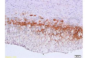 Formalin-fixed and paraffin embedded: rabbit carotid artery labeled with Anti-TGF-beta-R2/TGFBR2 Polyclonal Antibody (ABIN725225), Unconjugated 1:600 followed by conjugation to the secondary antibody and DAB staining (TGFBR2 anticorps  (AA 241-330))