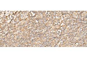 Immunohistochemistry of paraffin-embedded Human tonsil tissue using EIF3C Polyclonal Antibody at dilution of 1:35(x200)