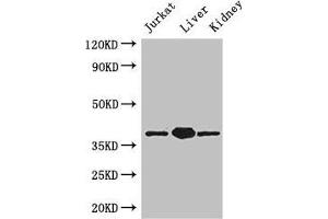 Western Blot Positive WB detected in: Jurkat whole cell lysate, Mouse liver tissue, Mouse kidney tissue All lanes: PINX1 antibody at 3. (PINX1 anticorps  (AA 151-299))