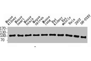 Western Blot analysis of rat-kidney hela 293T SH-SY5Y MOUSE-KIDNEY MOUSE-SPLEEN MOUSE-LUNG using ENPP3 Polyclonal Antibody.