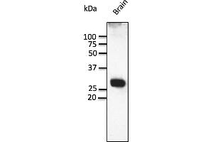 Western Blotting (WB) image for anti-RAB3A, Member RAS Oncogene Family (RAB3A) (C-Term) antibody (ABIN7272977) (RAB3A anticorps  (C-Term))