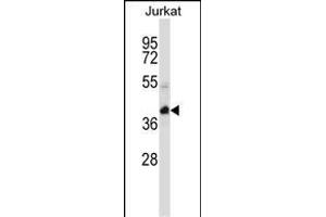 KCTD10 Antibody (C-term) (ABIN657313 and ABIN2846392) western blot analysis in Jurkat cell line lysates (35 μg/lane). (KCTD10 anticorps  (C-Term))