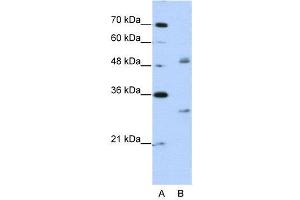 WB Suggested Anti-WBSCR1  Antibody Titration: 2. (EIF4H anticorps  (Middle Region))