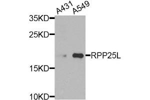 Western blot analysis of A431 and A549 of various cells, using RPP25L antibody. (RPP25L anticorps)