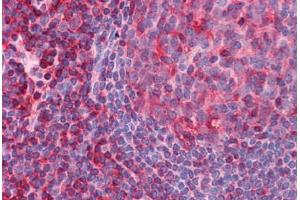 Human Tonsil: Formalin-Fixed, Paraffin-Embedded (FFPE)